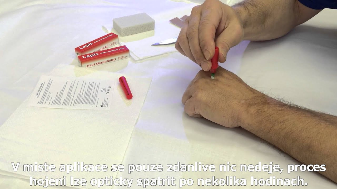 Jak použ&iacute;vat tyčinku na bradavice - Lapis Čertův kam&iacute;nek