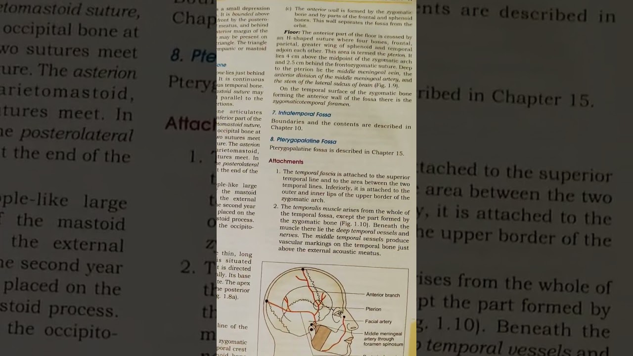 position of facial artery and middle meningeal artery with its anterior and posterior branch