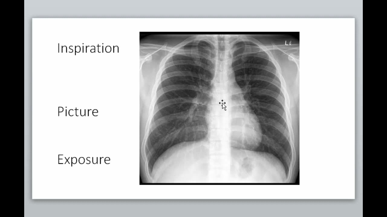 Basic Chest X-ray reading principles New Ethiopian Medical lecture በአማርኛ