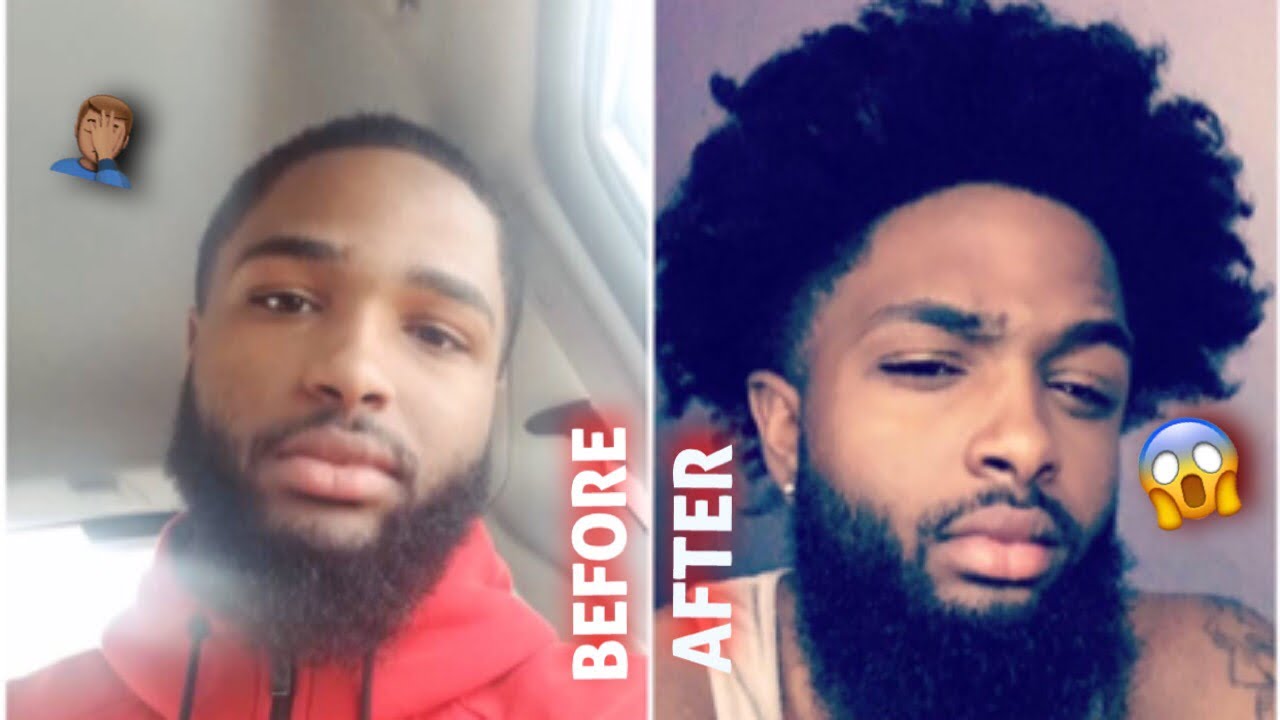 MEN&rsquo;S 1 YEAR NATURAL HAIR GROWTH JOURNEY | HOW TO GROW HAIR FAST | CRAZY GROWTH MUST SEE !