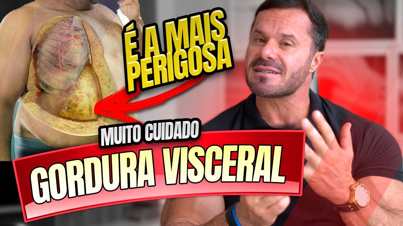 GORDURA VISCERAL - COMO EVITAR ?