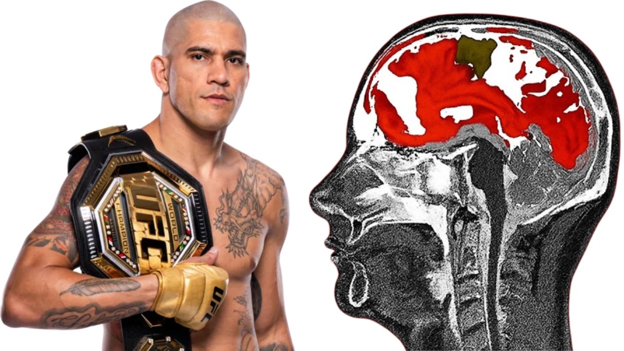 Рейтинг чемпионов UFC по степени повреждения мозга