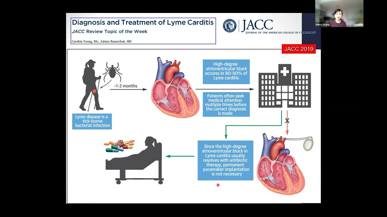 Long-term outcomes of Lyme carditis (Dr. Rachel Wamboldt and Dr. Nancy Wang)