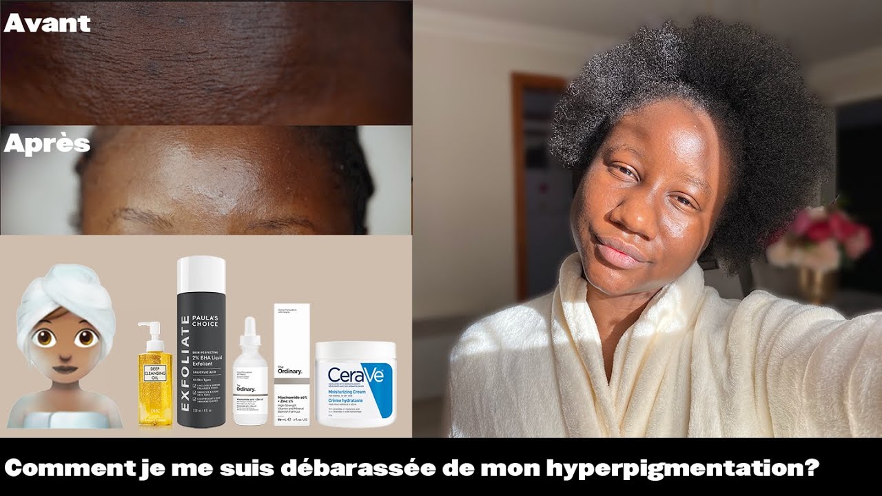 Ma routine soins de peau pour lutter contre l'hyperpigmentation sur peau noire I RÉSULTATS !!