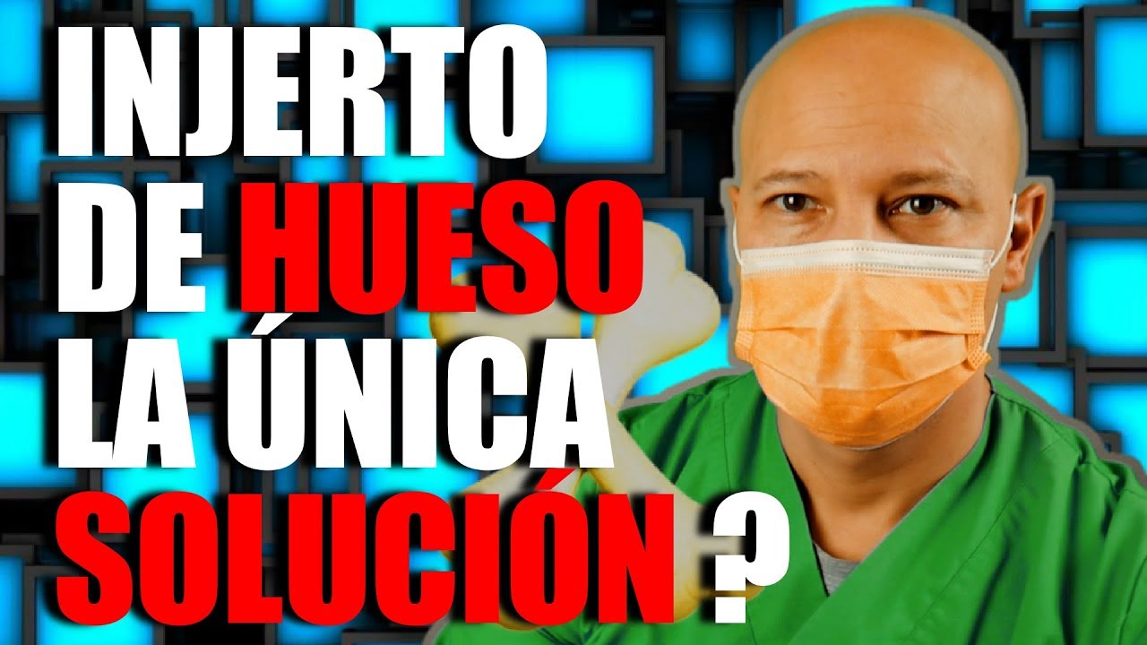 POCO HUESO? INJERTO de HUESO y otras ALTERNATIVAS!