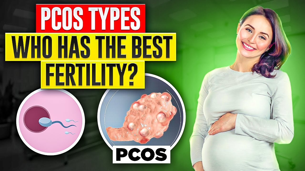 PCOS Fertility Potential - Which type is best?