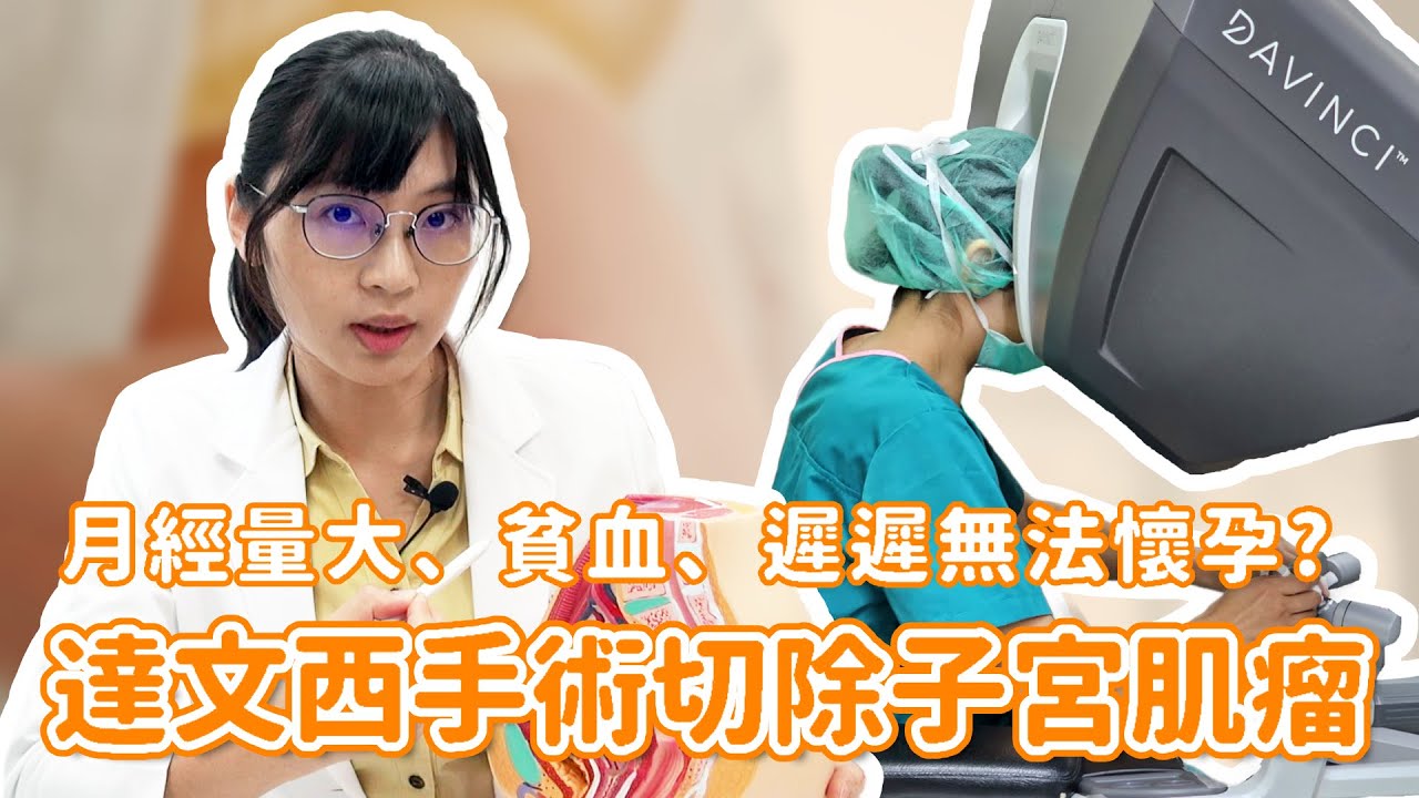 子宮劃刀後還能生育嗎？最詳盡的達文西子宮肌瘤切除術分享