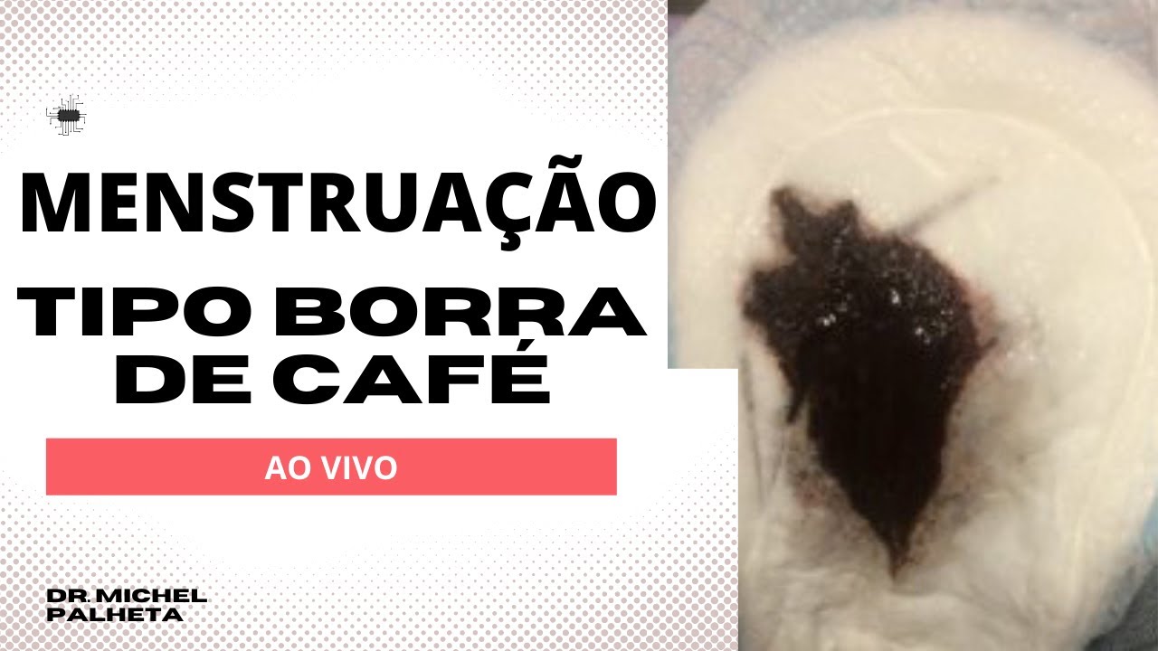 Menstruação escura tipo borra de café: Live de dúvidas