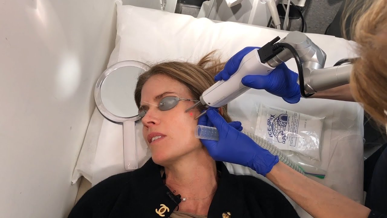 Gucci Zaps Dark Spots & Broken Capillaries with a Top Laser Derm | Westman Atelier