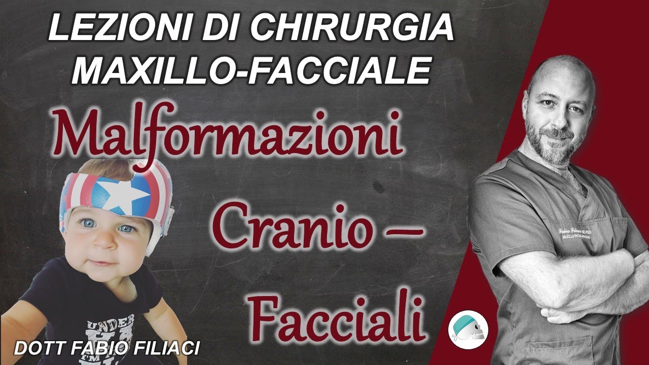 Lezioni di Chirurgia maxillo facciale: Malformazioni cranio maxillo facciali