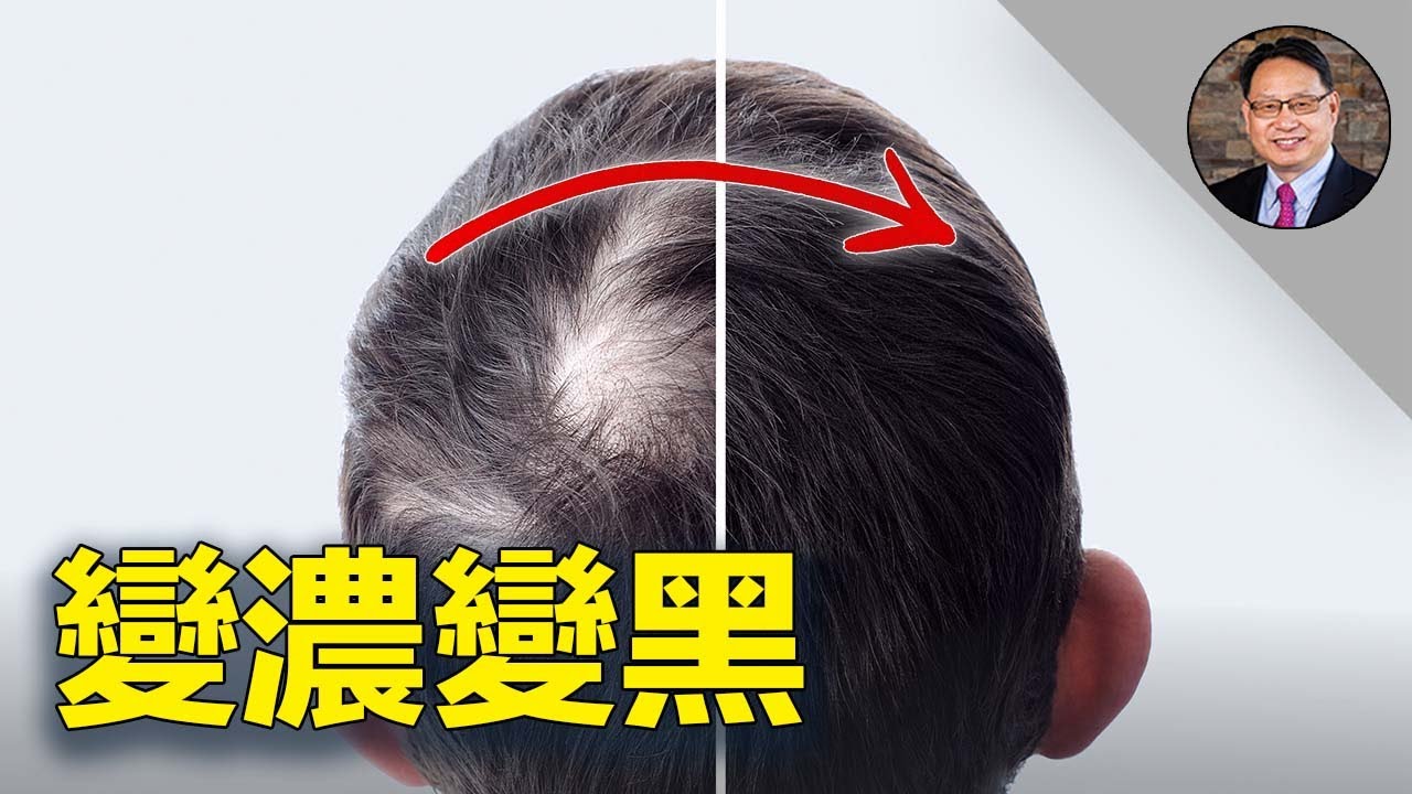 脫髮白髮？這些營養不能缺！中醫調理也能逆轉頭髮老化？