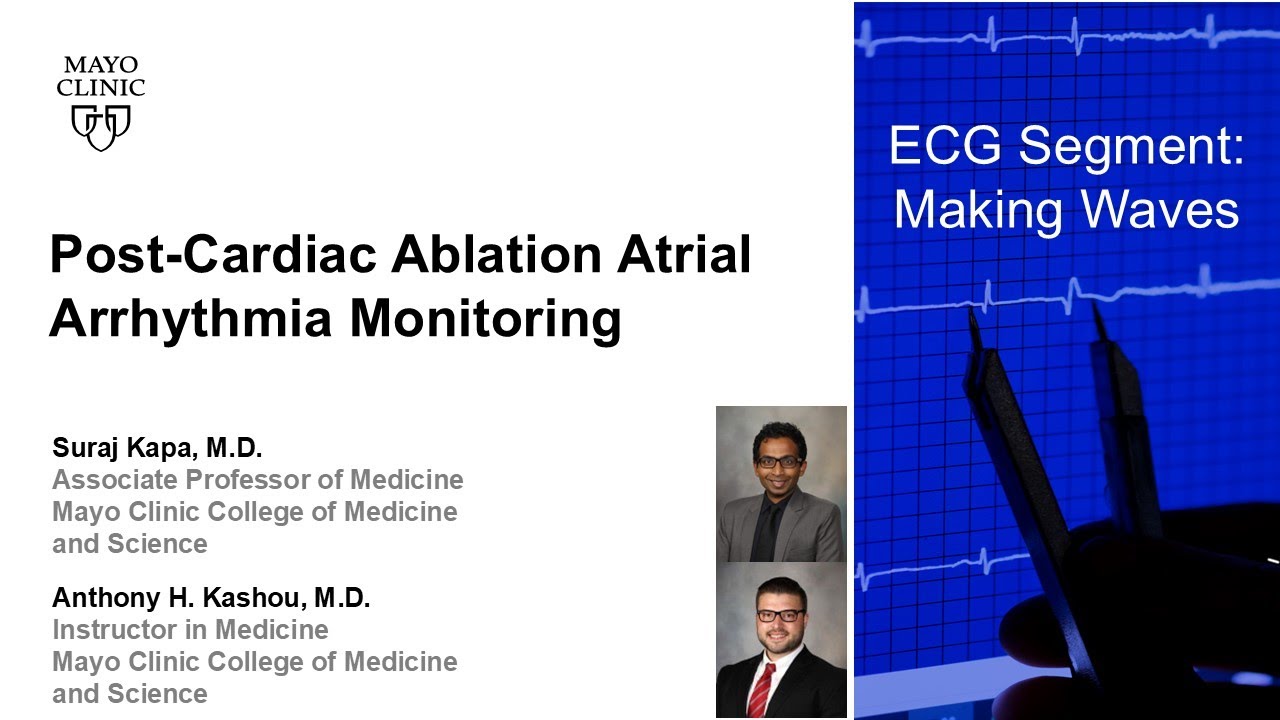 Post-Cardiac Ablation Atrial Arrhythmia Monitoring