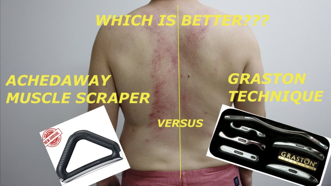ACHEDAWAY Autoheated Muscle scraper versus GRASTON TECHNIQUE