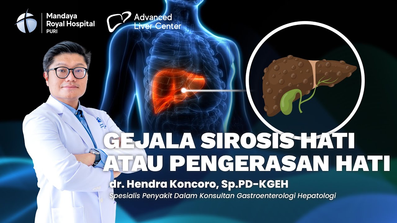 Ciri-Ciri Sirosis Hati yang Perlu Segera Diobati bersama dr. Hendra Koncoro, Sp.PD-KGEH