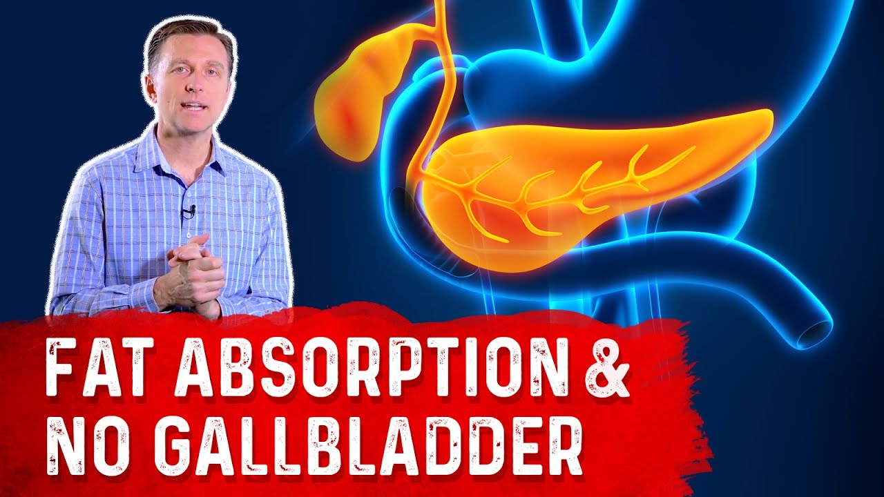 What Happens to Fat Absorption With NO Gallbladder? &ndash; Dr. Berg