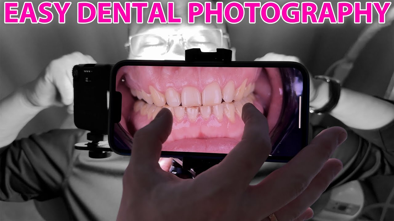 Easy Dental Photos and Videos with any Phone! Macro and Polarized Tricks