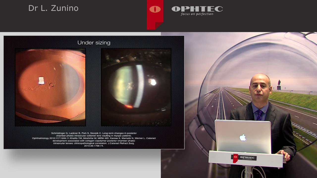 Why do posterior chamber PIOLs produce cataract? Dr Luis Zunino answers this question