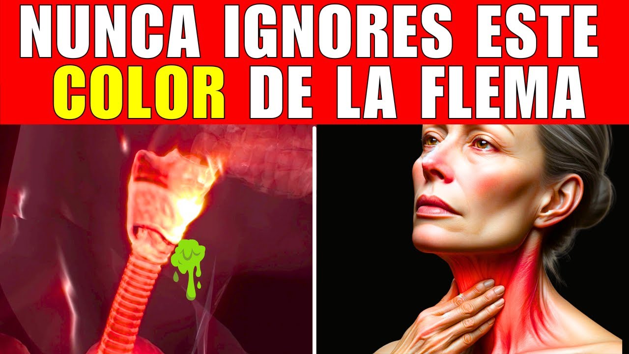 Este COLOR de MOCO dice MUCHO sobre TU SALUD (CAUSA y SOLUCIÓN)