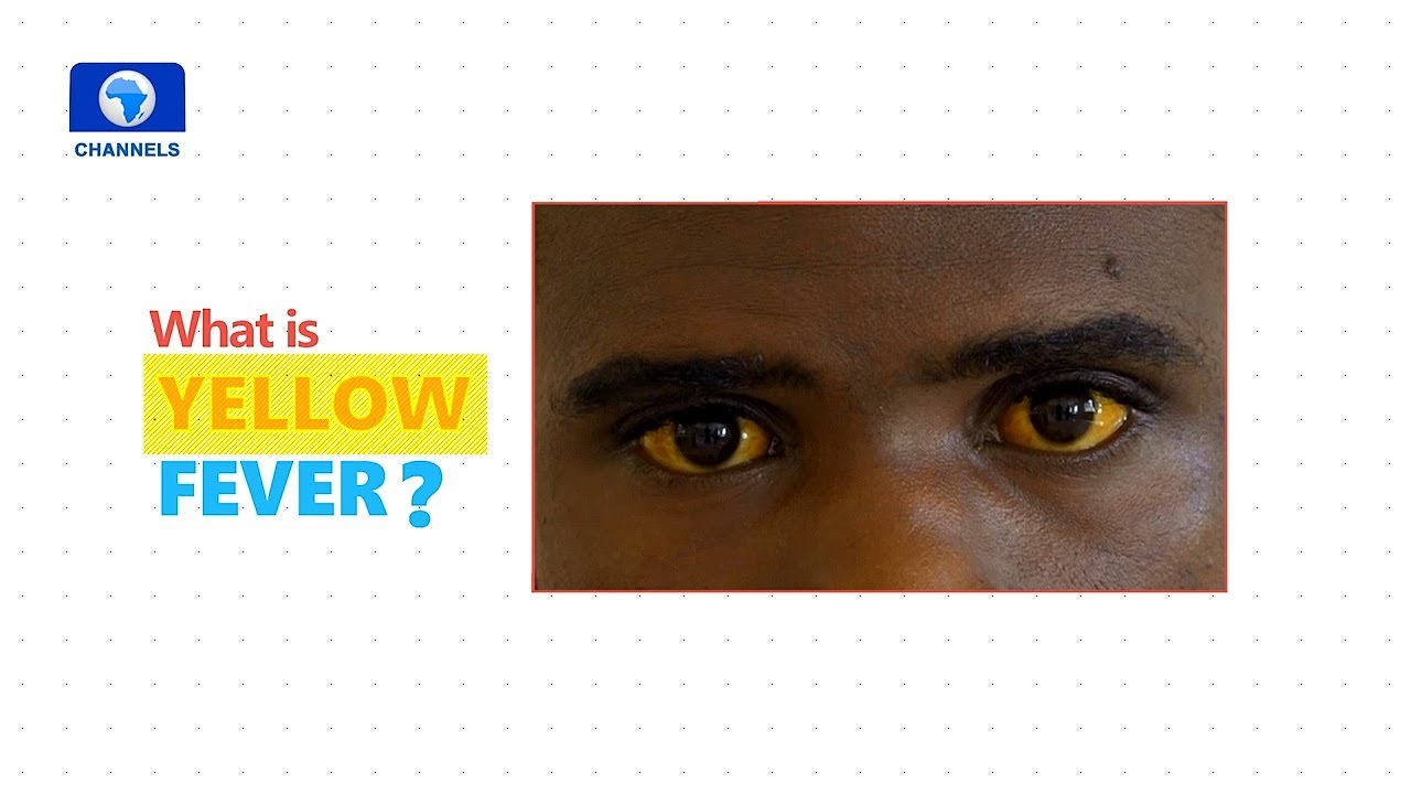 Infographic: Everything You Need To Know About Yellow Fever