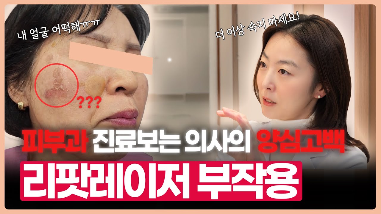 리팟 레이저 부작용, 진료과목 피부과 의사가 양심 고백합니다 (흑자 치료 부작용에 대한 모든 것)