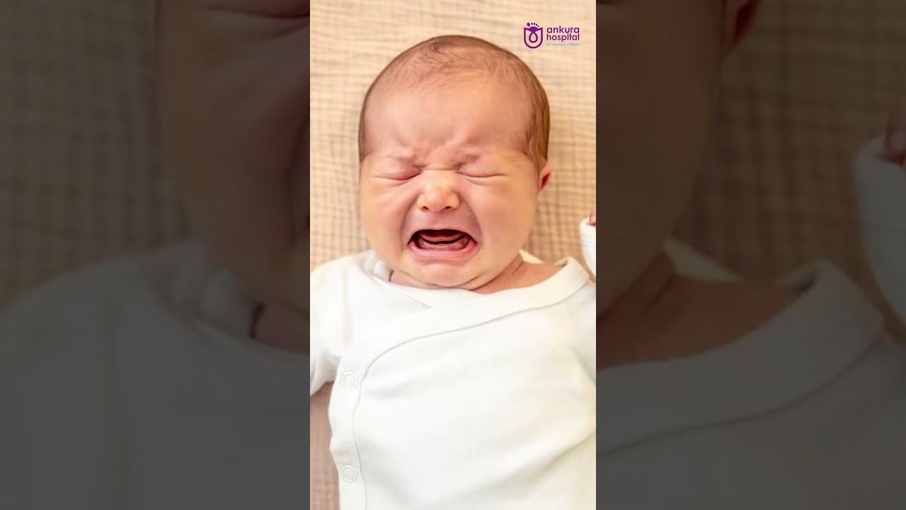 Understanding Gastroesophageal Reflux (GER) in Infants: Causes Symptoms and Management | Dr. Milind