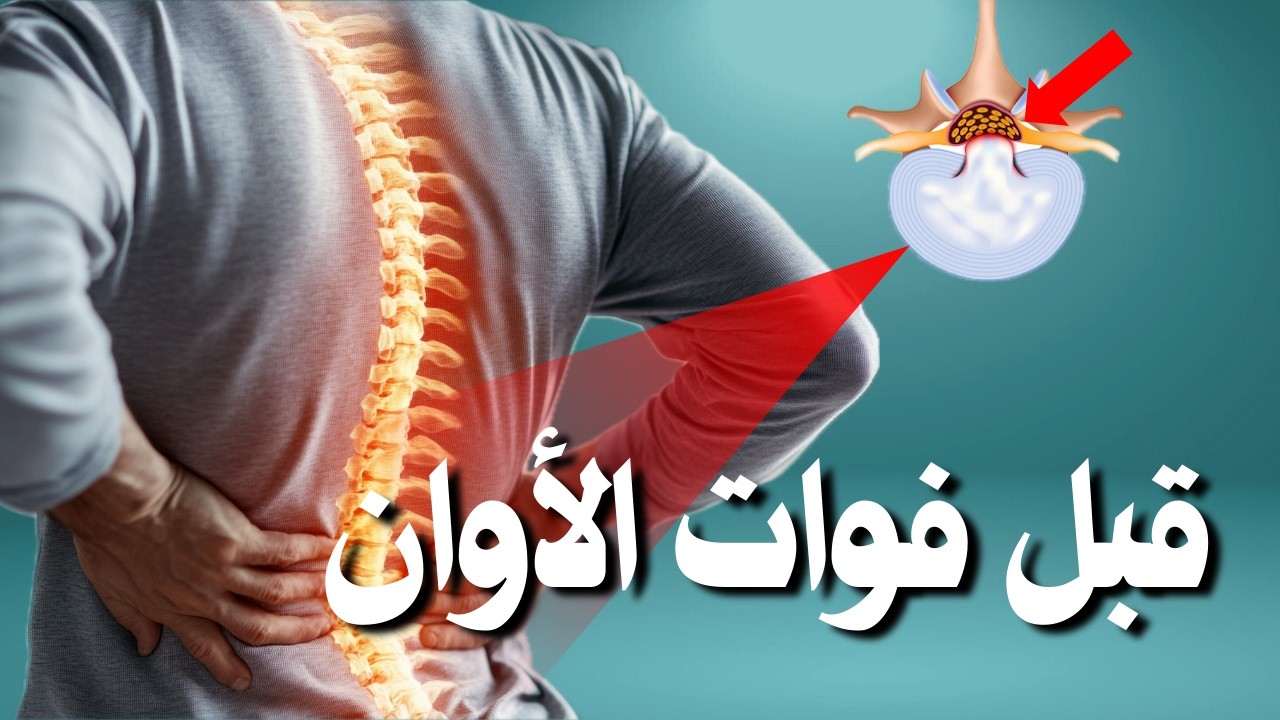 احذر! أعراض الانزلاق الغضروفي الطارئة التي قد تشير إلى متلازمة ذيل الفرس