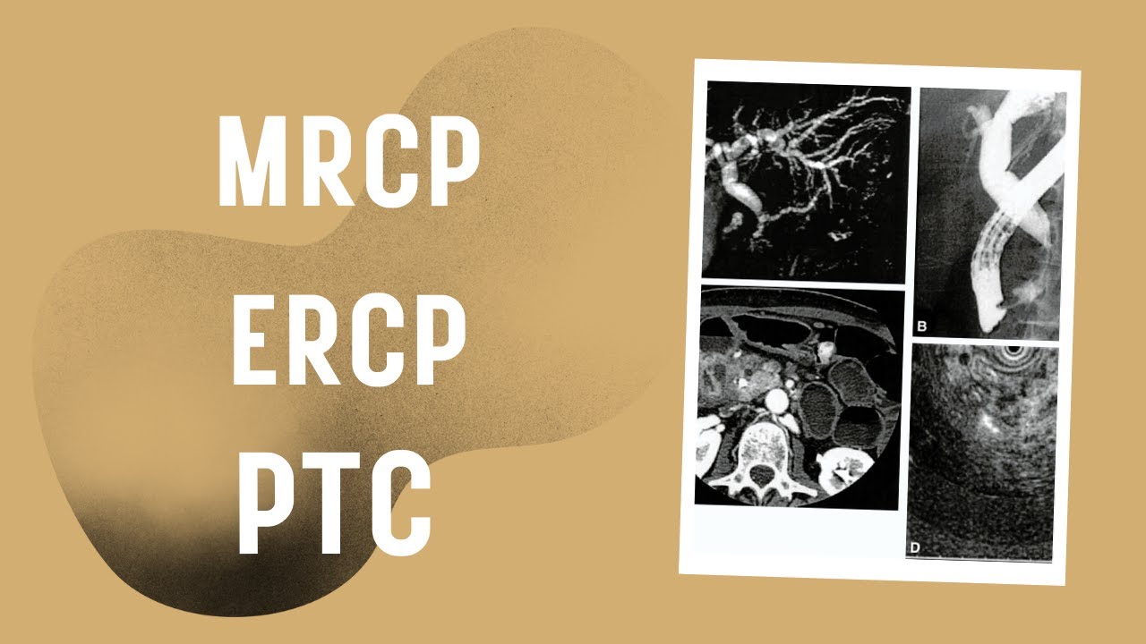 Role of MRCP, ERCP and PTC in diseases of bile ducts  #neetpg #usmle #fmge