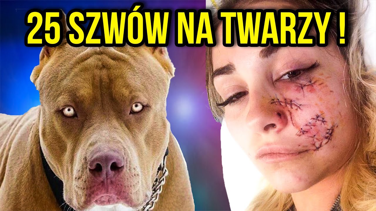 DLACZEGO PIES ZAATAKOWAŁ WŁAŚCICIELA ?!
