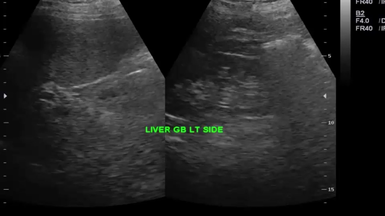 CASE 269 SITUS INVERSUS TOTALIS