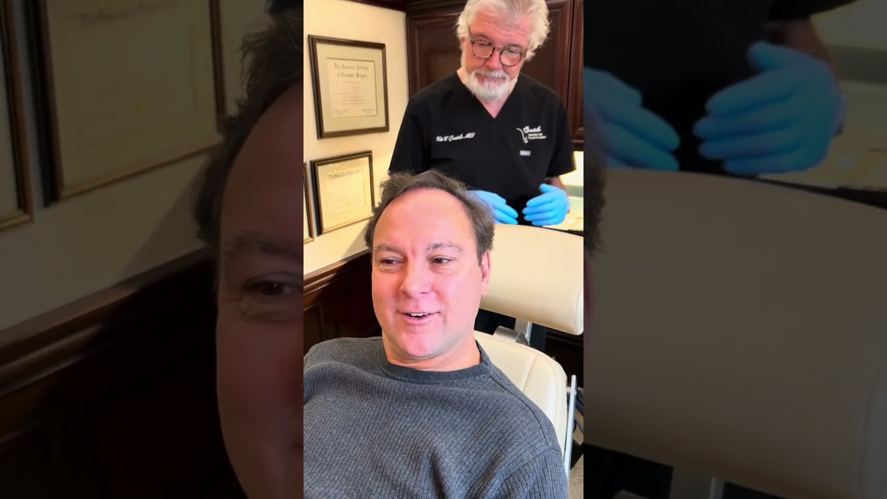 The Magic of Scalp Reductions for People With Hair Loss
