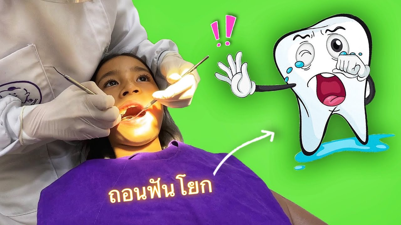 น้องไบรท์ฟันโยก 🦷 ต้องถอนฟันออก | บริ้งค์ไบรท์