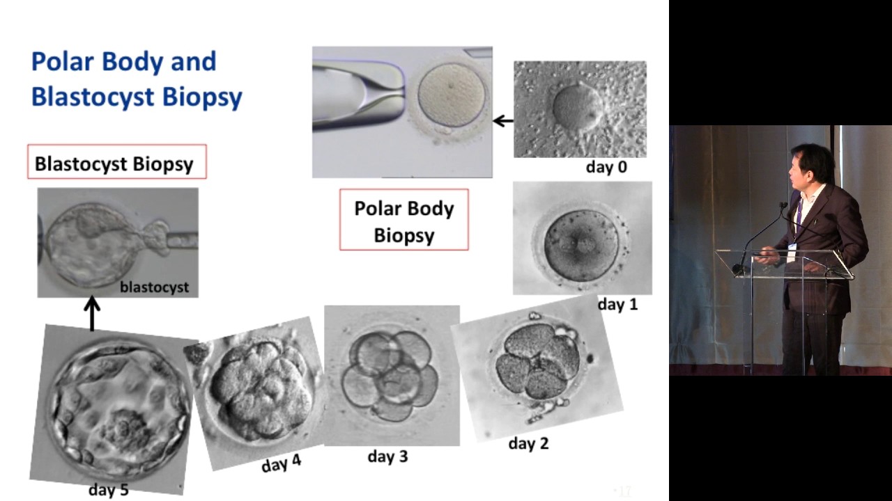 Single Cell Whole Genome Sequencing for PGD/PGS | Sunney Xie