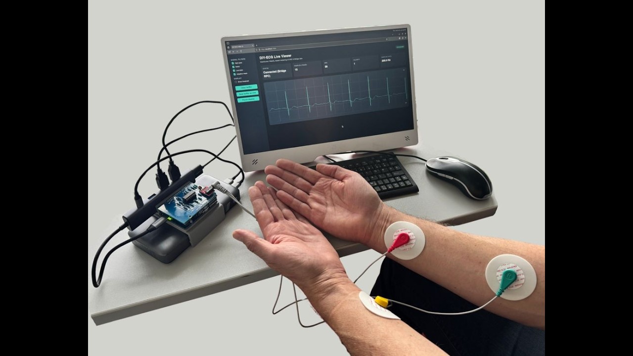Do-it-yourself Electrocardiogram DIY-ECG