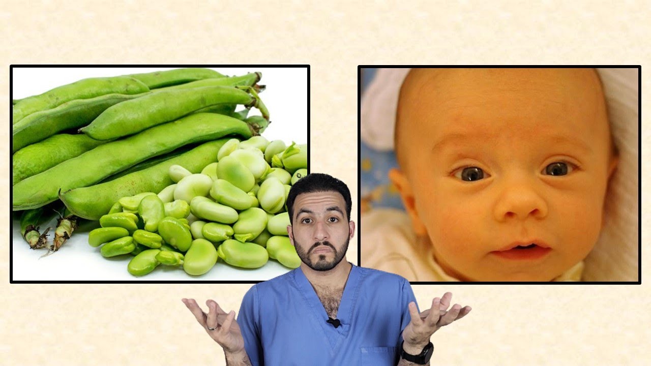 مرض نقص انزيم G6PD  (أنيميا الفول)