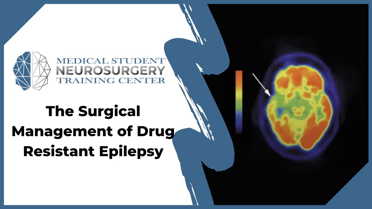 The Surgical Management of Drug Resistant Epilepsy