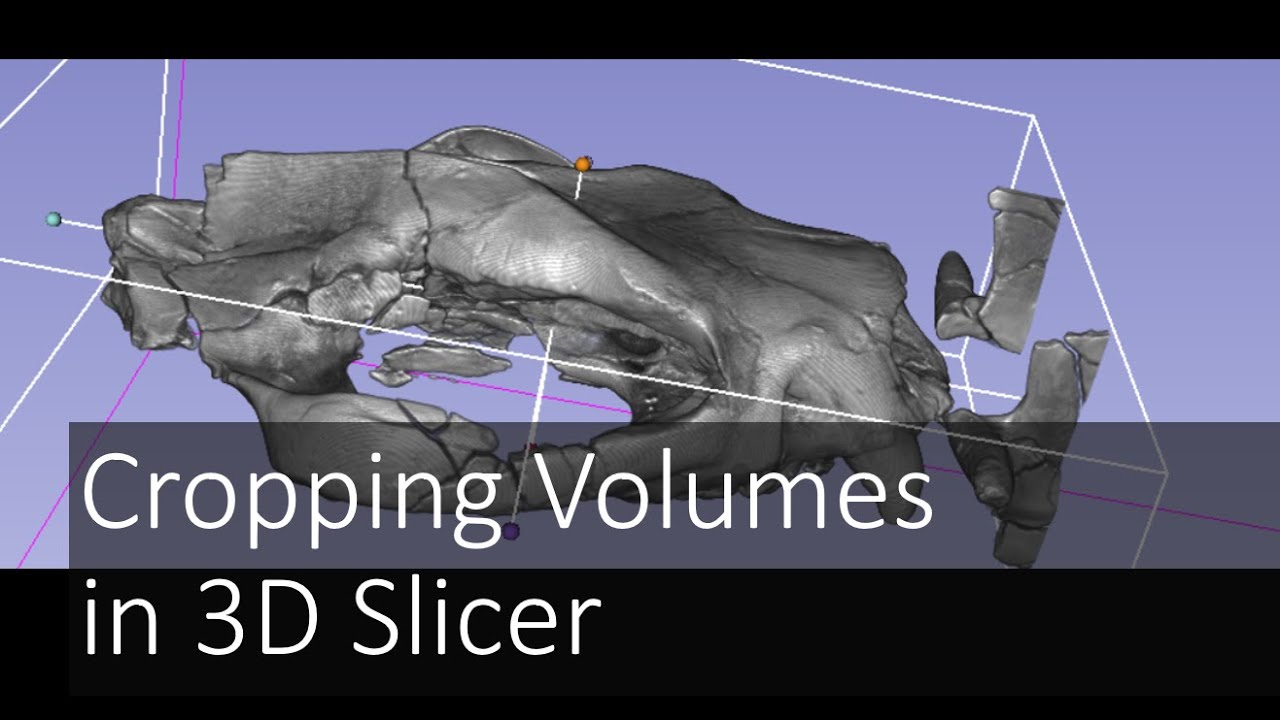 Cropping Volumes in 3D Slicer | Introduction to Digital Preparation Video 10