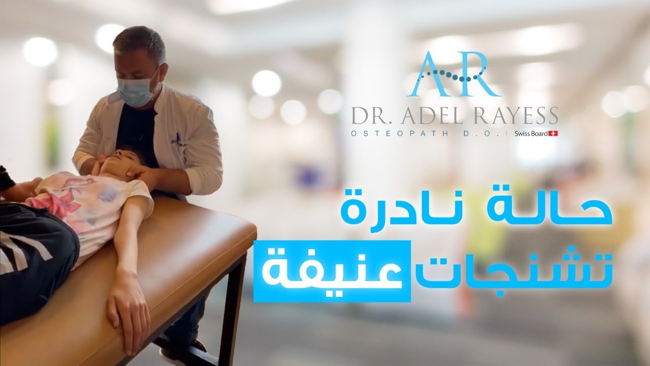 تشنجات عنيفة أصعب حالة يقوم بها الدكتور الريس في حياته المهنية