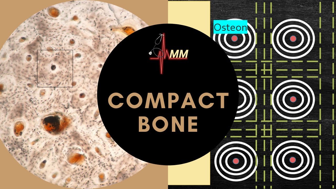 Compact Bone in detail | Osteons, Lamellae, Haversian canal, Volkmann canal | Med Madness