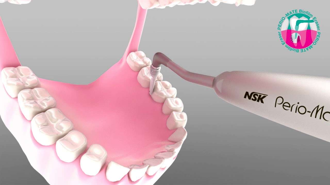 Perio mate – Biofilm Eraser