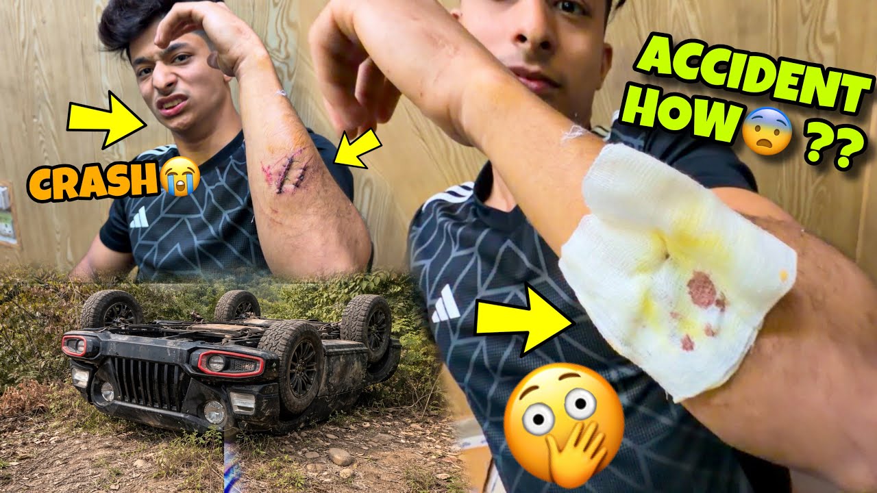 Accident kesa hua😭💔? | Full Story Explained😨 @aalyanvlogs1299 | My First Crash