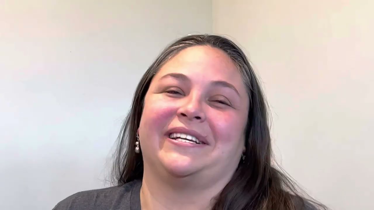 Just a few days after ZYGOMATIC IMPLANTS!