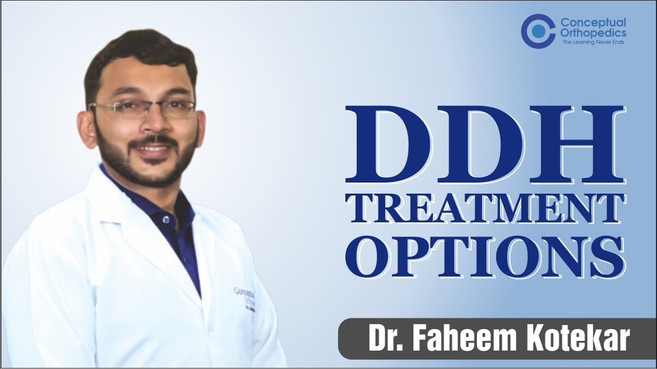 DDH - Treatment Options by Dr. Faheem Kotekar