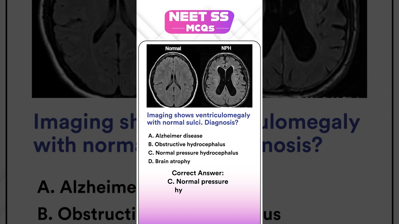 NEET SS MCQs  