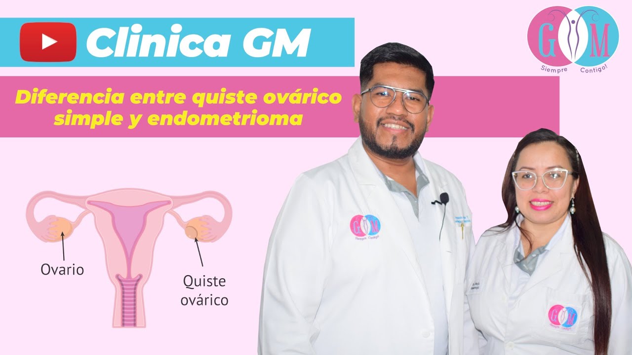 Diferencia entre quiste ovárico simple y endometrioma