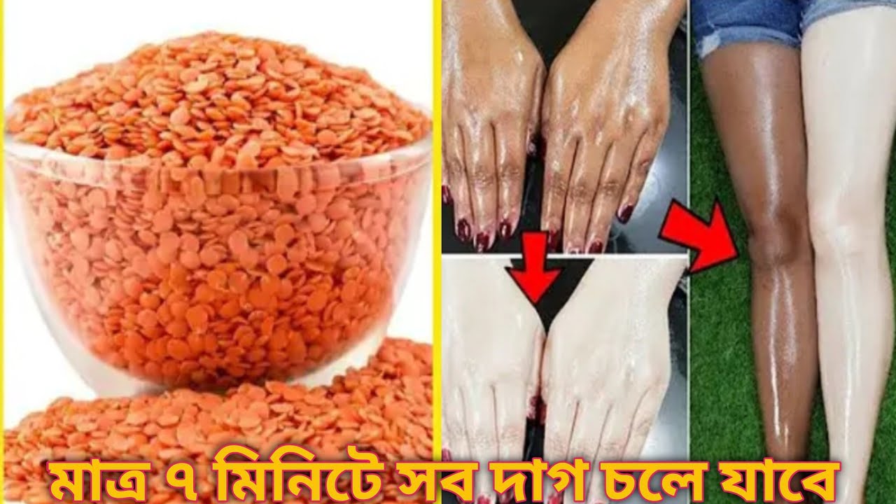 স্নানের আগে এই দুটি মিশ্রণ লাগিয়ে রাখো যত পুরাতন কালো দাগ ই হোক /চোখের পলকে গায়েব হয়ে যাবে / Skin