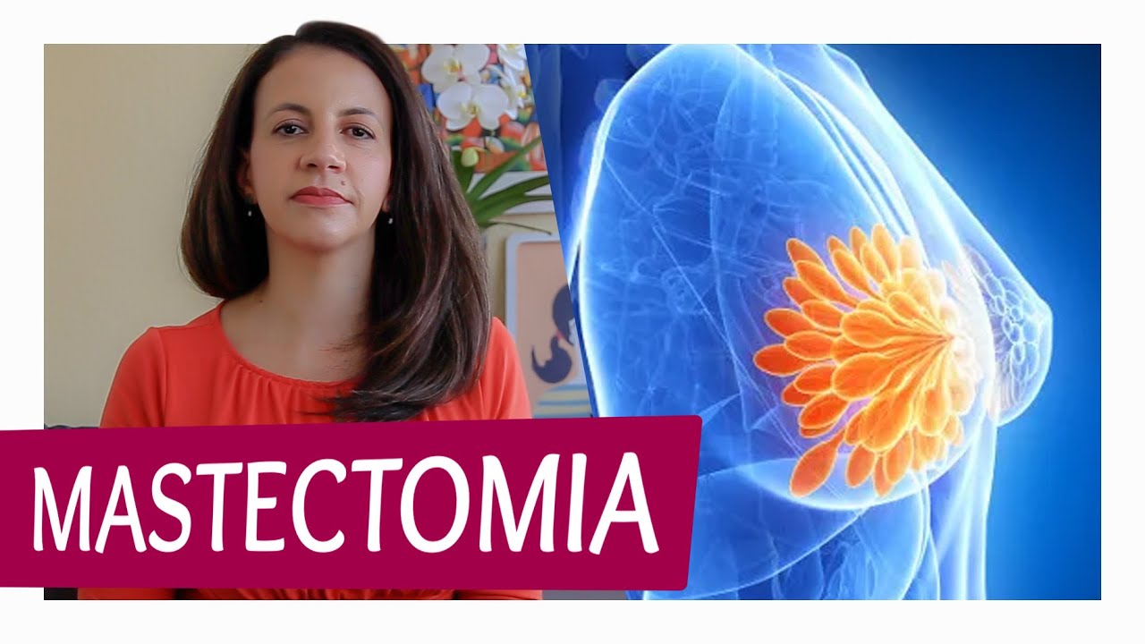 O que é Mastectomia?
