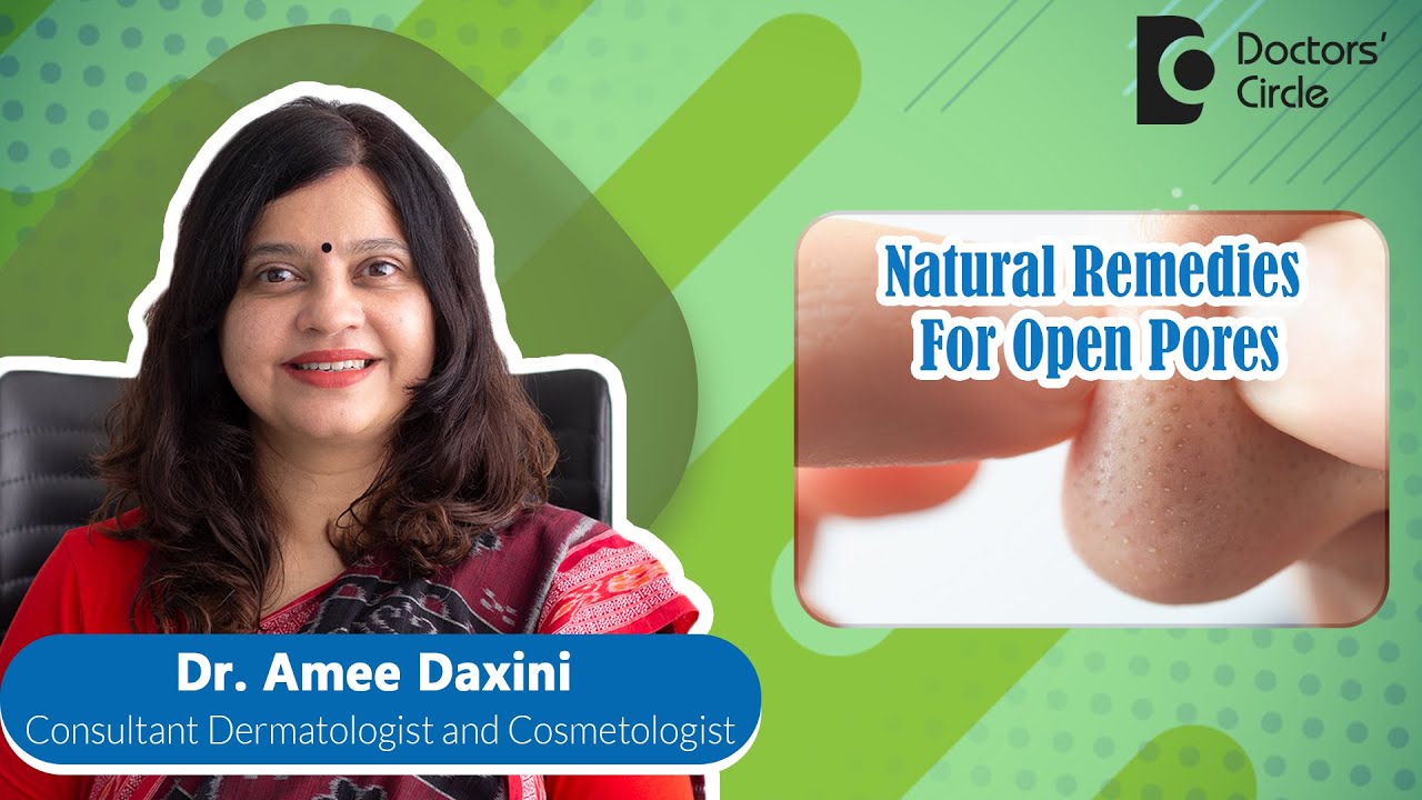 Home Remedies For Open Pores for 100% Clear Skin #skincare  - Dr. Amee Daxini | Doctors' Circle
