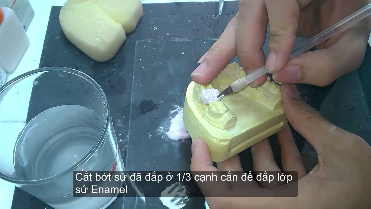 Quy trình đắp sứ Ceramco 3 căn bản