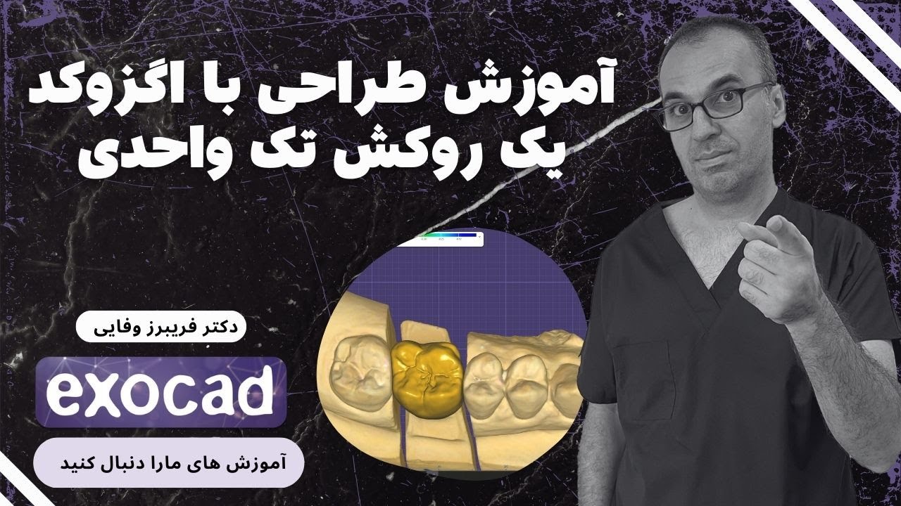 طراحی یک روکش یک واحدی