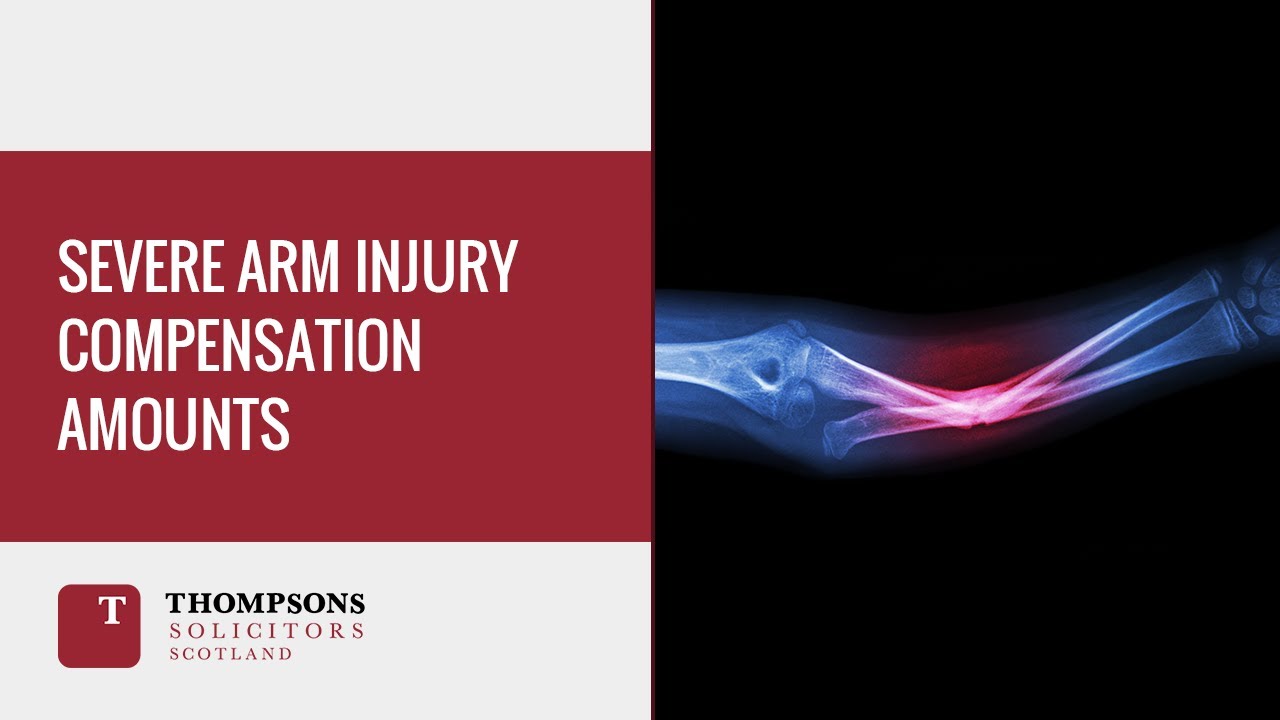 Severe Arm Injury Compensation Amounts